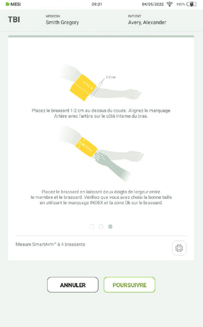 RÉALISER UNE MESURE DE L’IPSO-4a