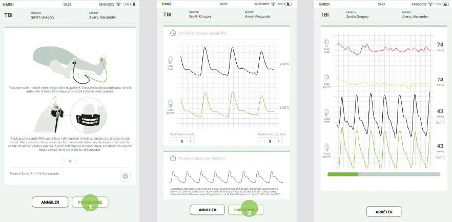 RÉALISER UNE MESURE DE L’IPSO-5