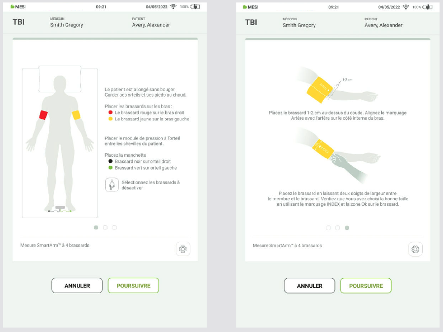 RÉALISER UNE MESURE DE L’IPSO-4