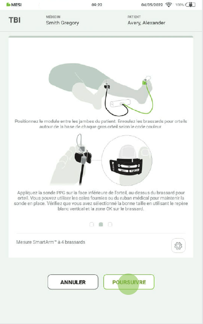 RÉALISER LA MESURE DE L’IPSO-6