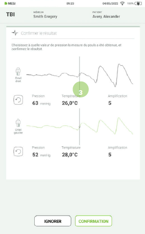 RÉALISER LA MESURE DE L’IPSO-8