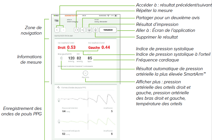 ANALYSER LA MESURE DE L’IPSO-1