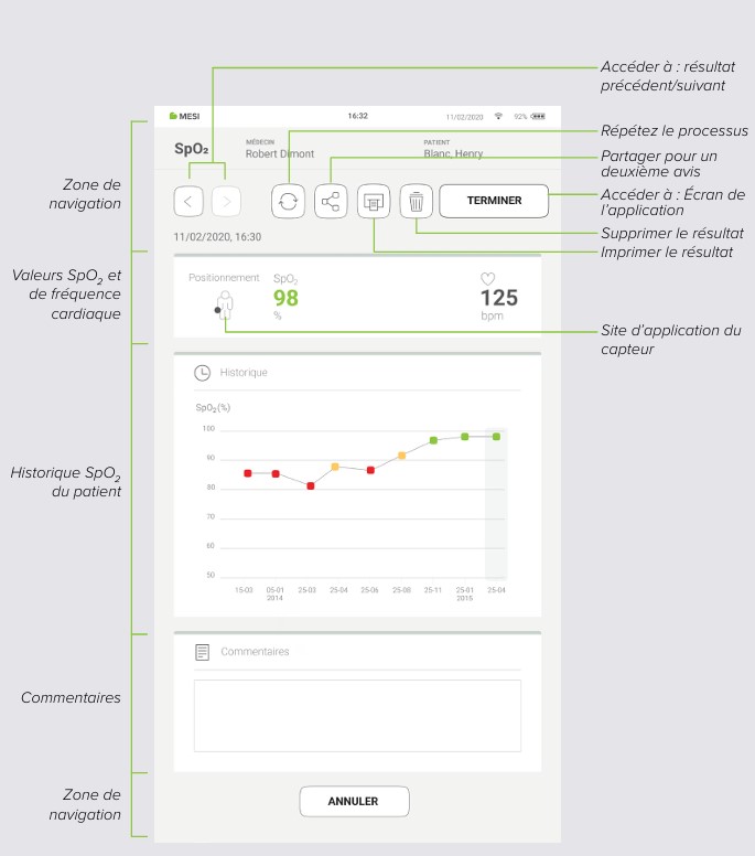 MESI mTABLET SPO2 - ANALYSE DE LA MESURE SpO₂