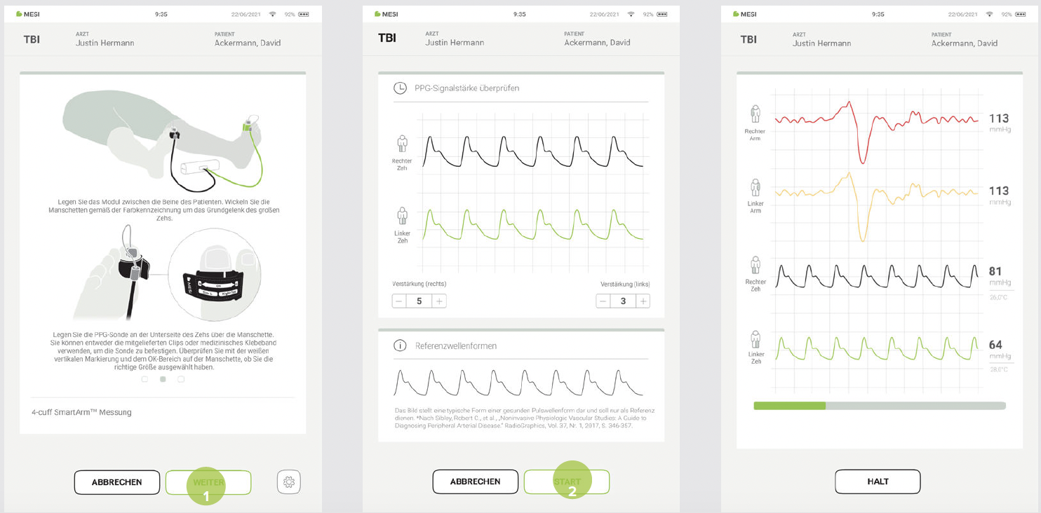 DURCHFÜHRUNG EINER TBI-MESSUNG-5