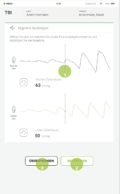 DURCHFÜHRUNG EINER TBI-MESSUNG-6