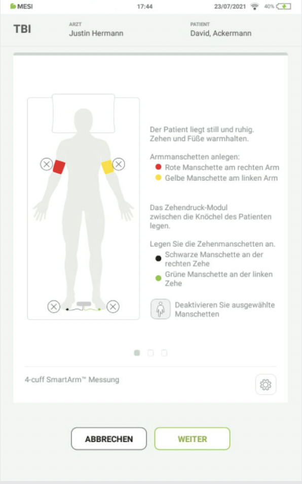 DURCHFÜHRUNG DER TBIMESSUNG-4