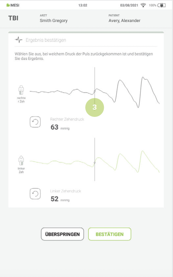 DURCHFÜHRUNG DER TBIMESSUNG-8