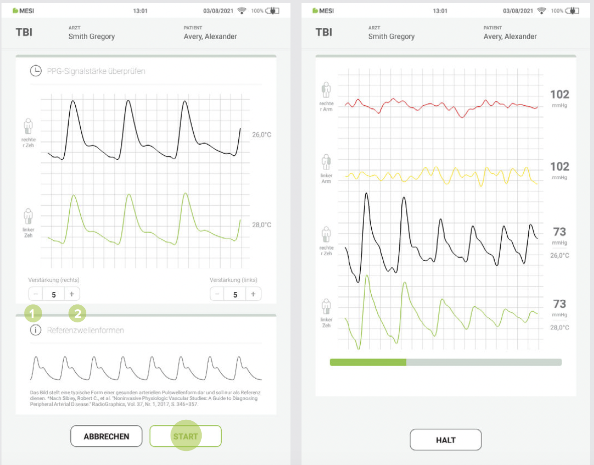 DURCHFÜHRUNG DER TBIMESSUNG-7