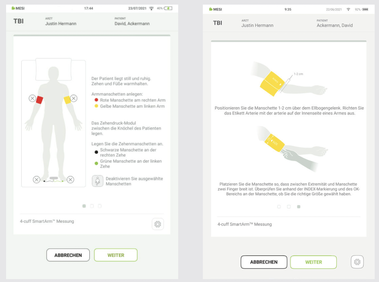 DURCHFÜHRUNG DER TBIMESSUNG-5