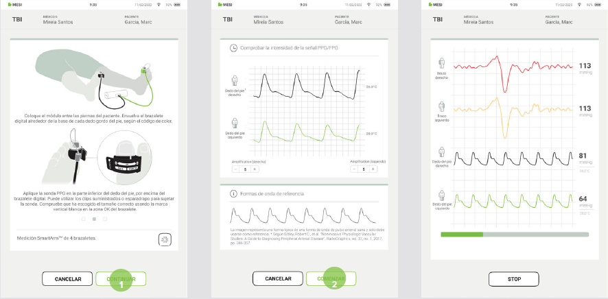 REALIZAR UNA MEDICIÓN DEL IDB-6