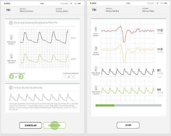 REALIZAR LA MEDICIÓN DEL IDB-7