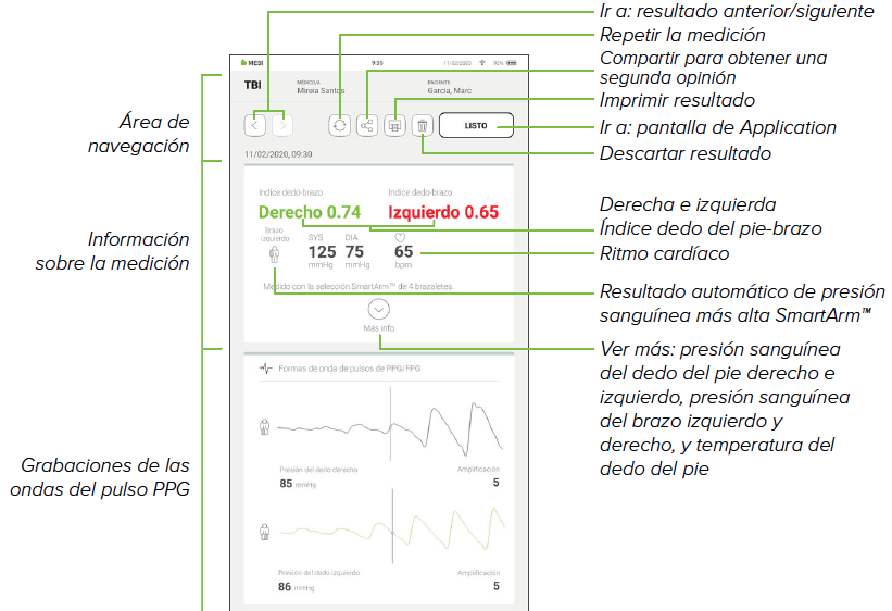 REVISAR UNA MEDICIÓN DEL IDB-1