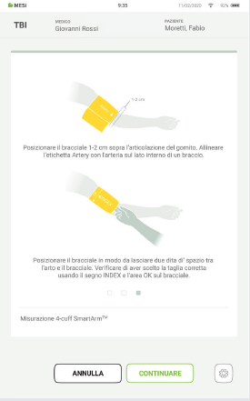 EFFETTUARE UNA MISURAZIONE DEL TBI-5