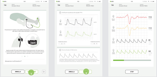 EFFETTUARE UNA MISURAZIONE DEL TBI-6