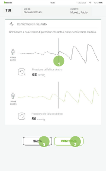 EFFETTUARE UNA MISURAZIONE DEL TBI-7