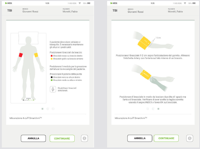 EFFETTUARE UNA MISURAZIONE DEL TBI-4