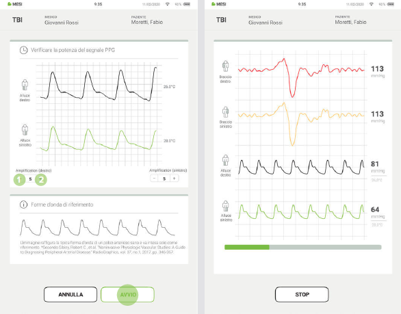 EFFETTUARE UNA MISURAZIONE DEL TBI-6