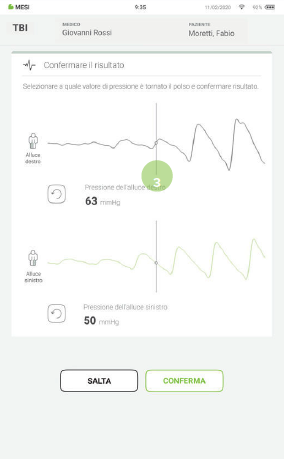 EFFETTUARE UNA MISURAZIONE DEL TBI-7