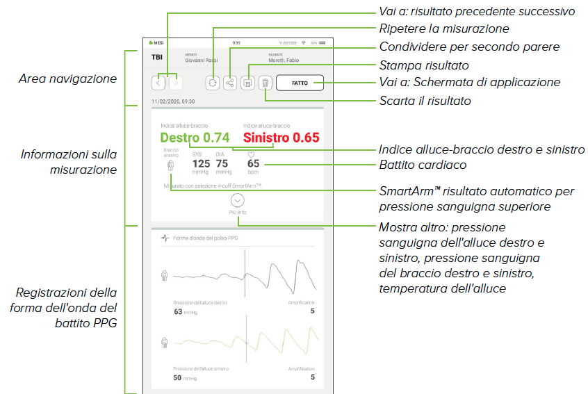 RIVEDERE UNA MISURAZIONE DEL TBI -1