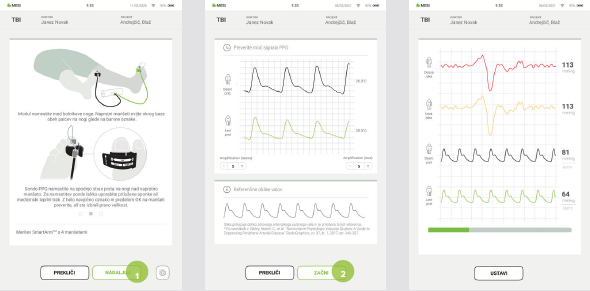 IZVEDBA MERITVE TBI-6