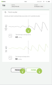 IZVEDBA MERITVE TBI-7