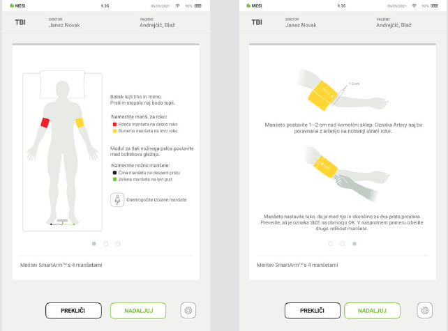 IZVEDBA MERITVE TBI-5