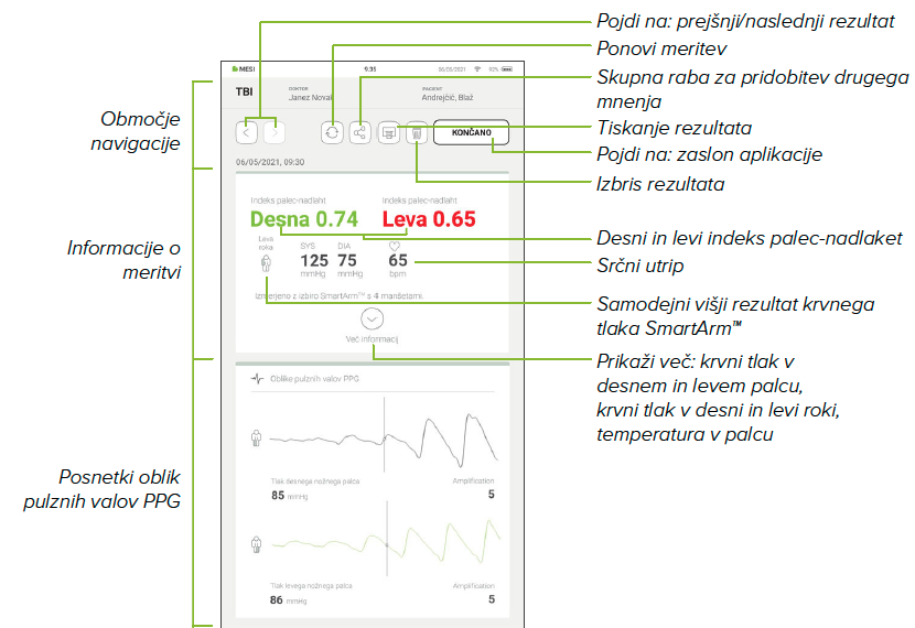 IZVEDBA MERITVE TBI-9