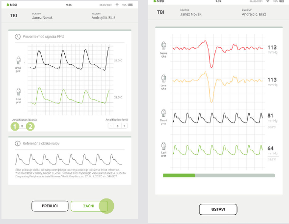 IZVEDBA MERITVE TBI-7