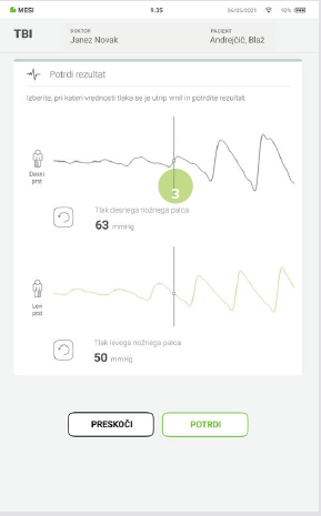 IZVEDBA MERITVE TBI-8