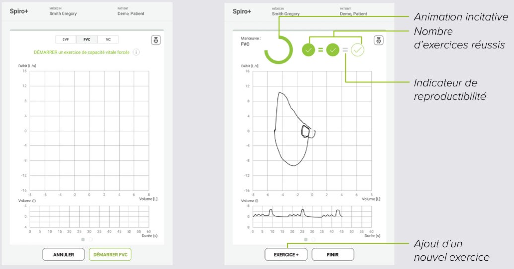 MESI mTABLET SPIRO -EXERCICE FVC SPIRO+ FVC - Étape 1