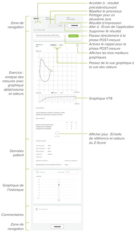 MESI mTABLET SPIRO -ANALYSE DE MESURE SPIRO+