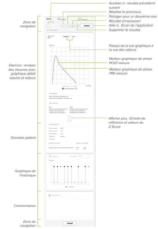 MESI mTABLET SPIRO -ANALYSE DU RÉSULTATS EN PHASE POSTMESURE