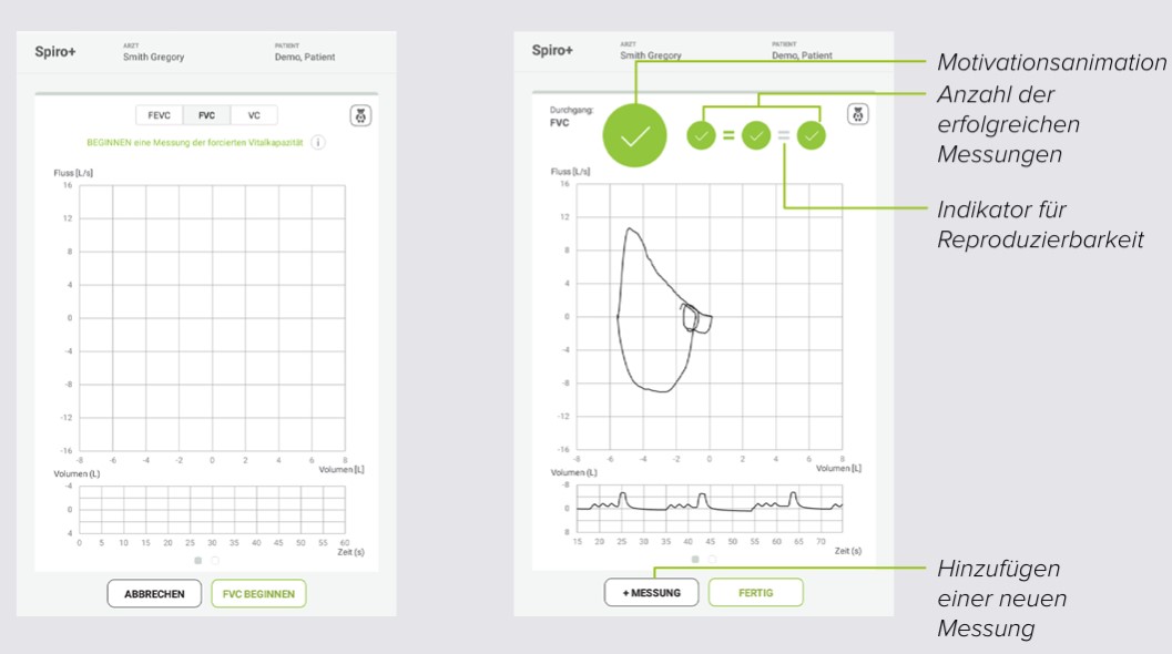 MESI mTABLET SPIRO+ FVC-MESSUNG- Schritt 1
