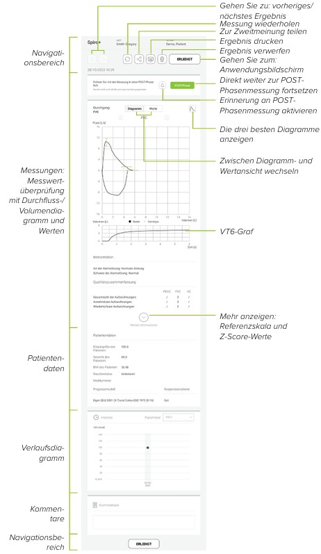 MESI mTABLET SPIRO - ÜBERPRÜFUNG VON SPIRO+ MESSUNGEN