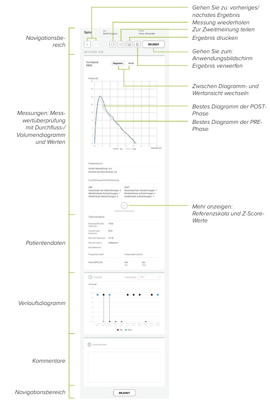 MESI mTABLET SPIRO - PRÜFUNG DER ERGEBNISSE DER POSTMESSPHASE