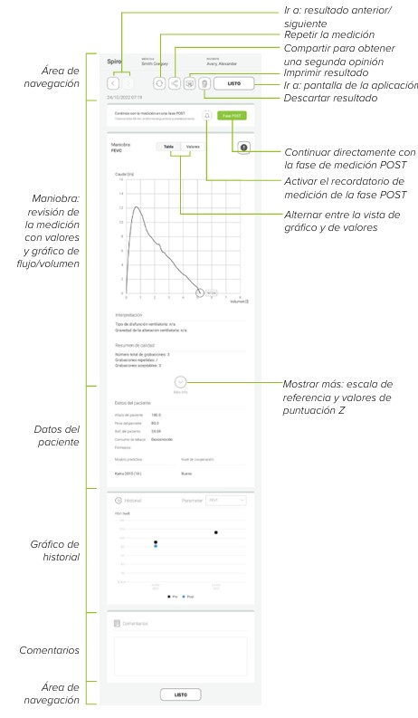 MESI mTABLET SPIRO - REVISAR UNA MEDICIÓN SPIRO