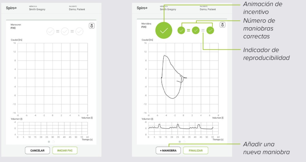MESI mTABLET SPIRO - MANIOBRA SPIRO+ FVC- Paso 1