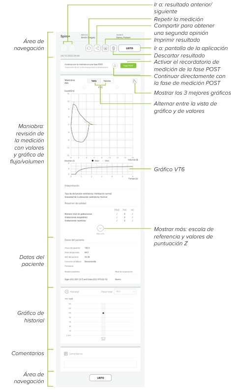 MESI mTABLET SPIRO - REVISAR UNA MEDICIÓN SPIRO+