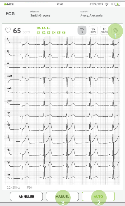 MESI mTABLET ECG - PERFORMING ECG RECORDING - Step 4,5