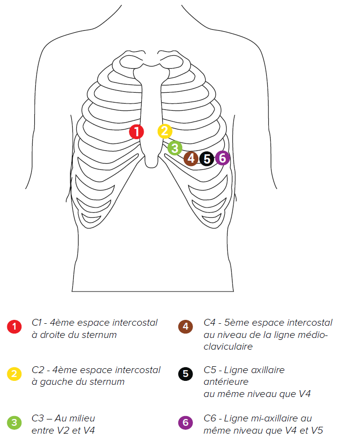 MESI mTABLET ECG - Electrode placement (2)