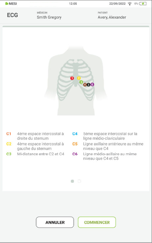 MESI mTABLET ECG - Recording the ecg - Step 3