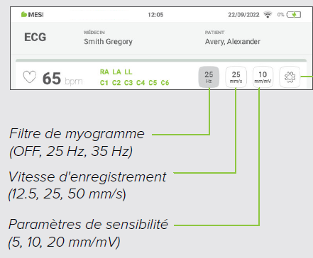 MESI mTABLET ECG - Recording the ecg - Step 8
