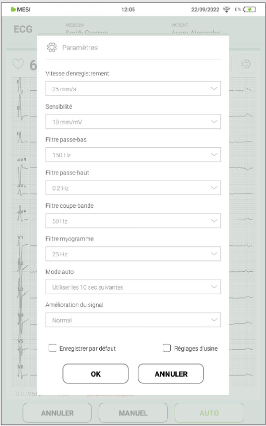 MESI mTABLET ECG - Recording the ecg - Step 9