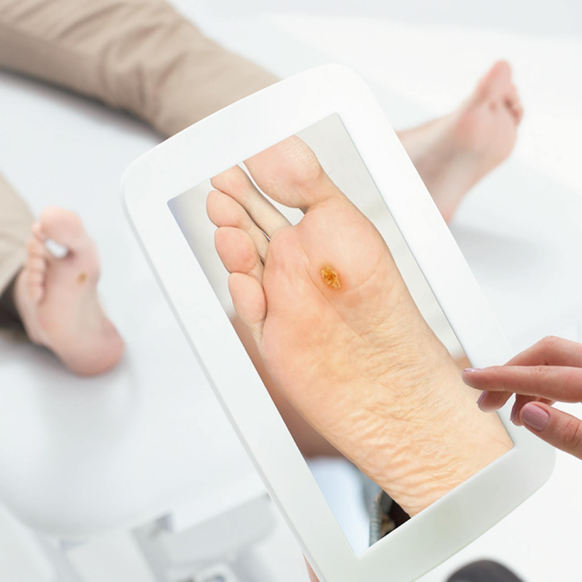 MESI mTABLET for Podiatry
