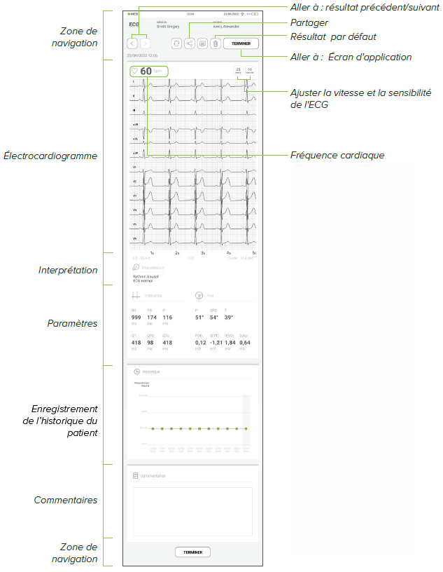 MESI mTABLET ECG - Reviewing ECG