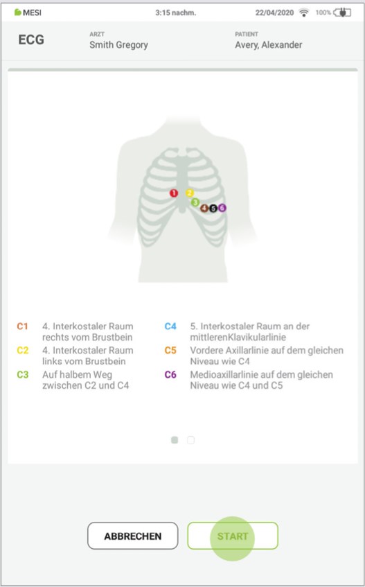 MESI mTABLET ECG-DURCHFÜHRUNG DER EKGAUFZEICHNUNG - Schritt 3