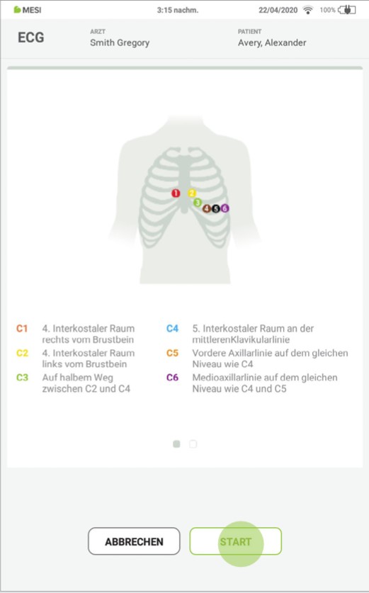MESI mTABLET ECG-EKGAUFZEICHUNUNG- Schritt 6