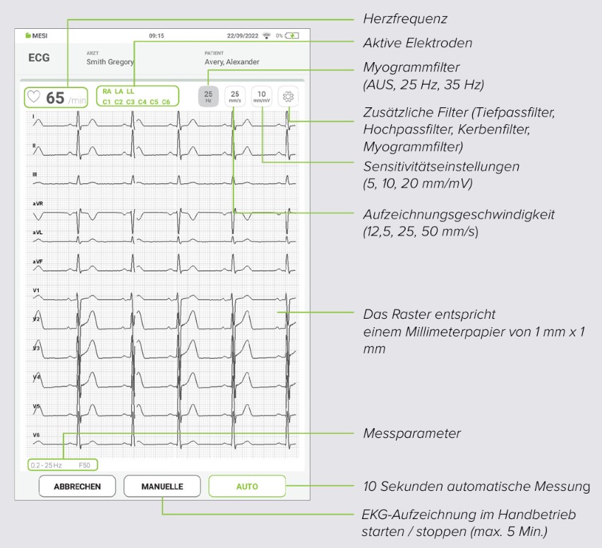 MESI mTABLET ECG-EKGAUFZEICHUNUNG- Schritt 7
