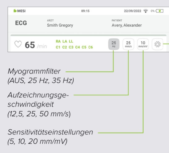 MESI mTABLET ECG-EKGAUFZEICHUNUNG- Schritt 8
