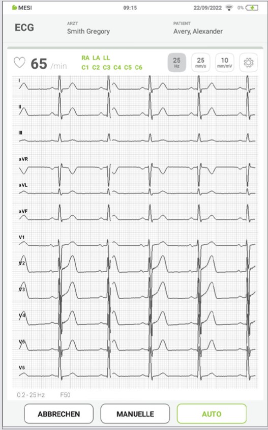 MESI mTABLET ECG-EKGAUFZEICHUNUNG- Schritt 10